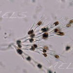 Dinobryon cf. cilindricum var. alpinun