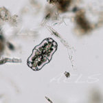 Euastrum 10x