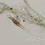 Gomphonema coronatum
