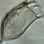 Keratella cochlearis 40xdic