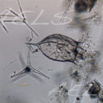 Keratella2 20x