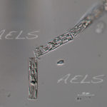 Tabellaria cadena 40xdic