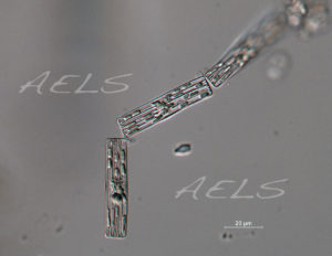 Tabellaria cadena 40xdic