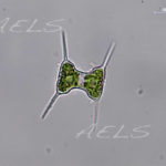 Staurodesmus extensus