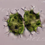 Xanthidium armatum 40X DIC 2d