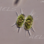 Xanthidium antilopaeum 40X DIC