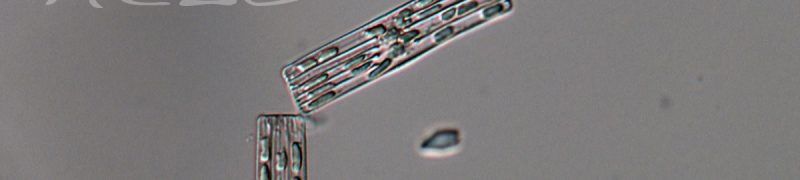 Tabellaria cadena 40xdic Tabellaria cadena 40xdic